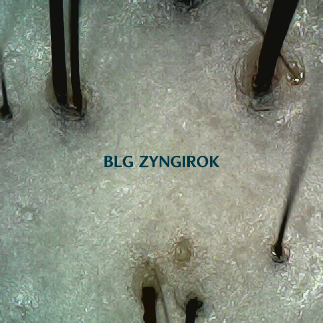 탈모 극복 프로젝트 - 정수리와 이마 사이 두피 모습이다.