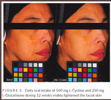 엘시스테인 효능