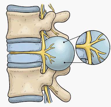 뇌척수액과 척수건강