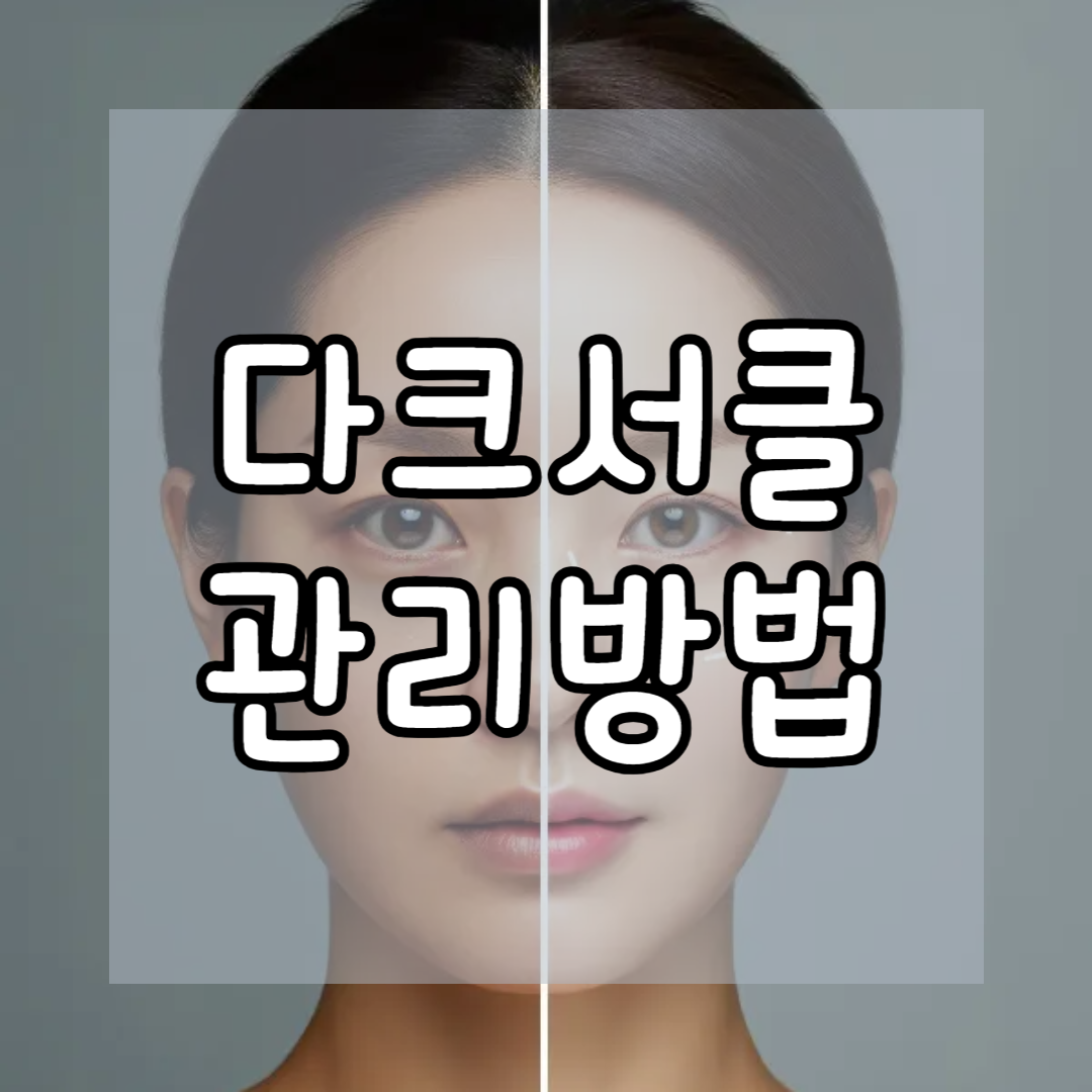 다크서클 없애는 생활습관