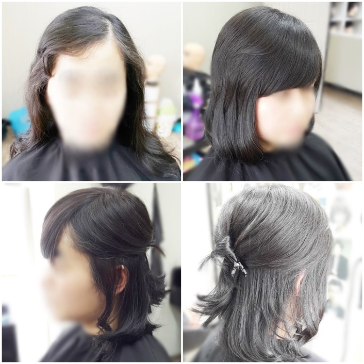 이건뭐고 탈모 성지 모발이식 헤어라인 교정 전문 병원, 맞춤 가발, 부분가발, 항암가발, 정수리가발 추천