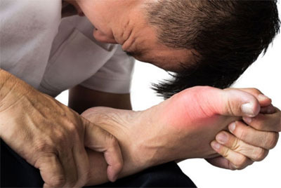 통풍에 좋은 음식과 나쁜음식