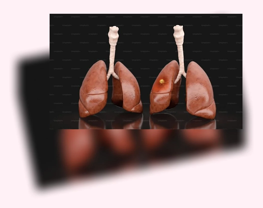 간 해독_2_subsection