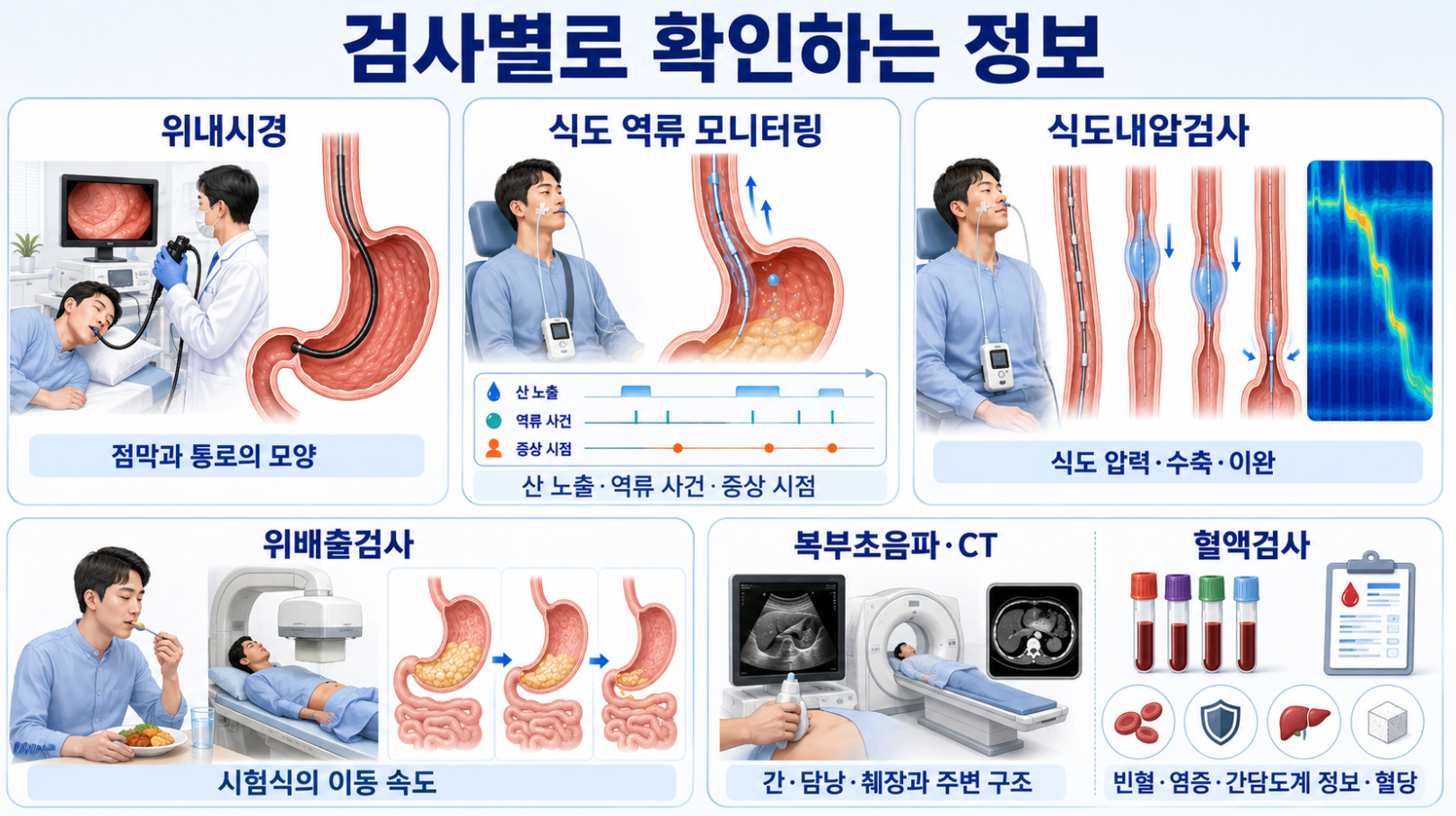 위내시경·역류 모니터링·식도내압·위배출·복부영상·혈액검사 비교