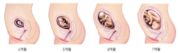 alt="임신"
