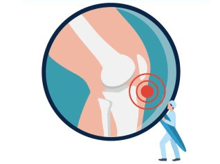 퇴행성 관절염의 주요 원인 대표적 신체 징후 검사방법 약물 및 수술