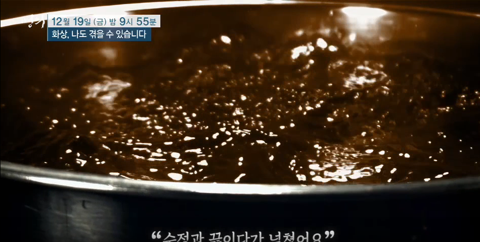 명의 화상 나도 겪을 수 있다