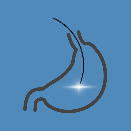 내시경-검사-이미지-예시