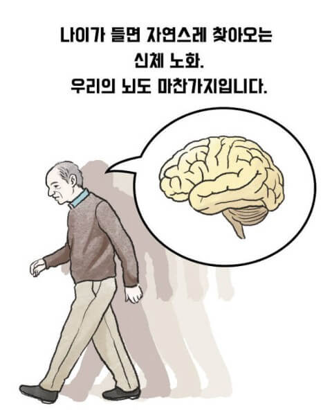 뇌노화