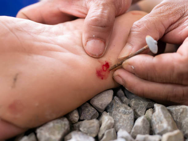 파상풍 초기증상 및 주사 기간과 아이들 예방접종 기간, 성인 예방접종 기간을 알아봤습니다. 파상풍은 우리가 생각하는 것보다 훨씬 위험한 질병이고 합병증이 무서운 질병이니 내용을 잘 숙지하기기 바랍니다.