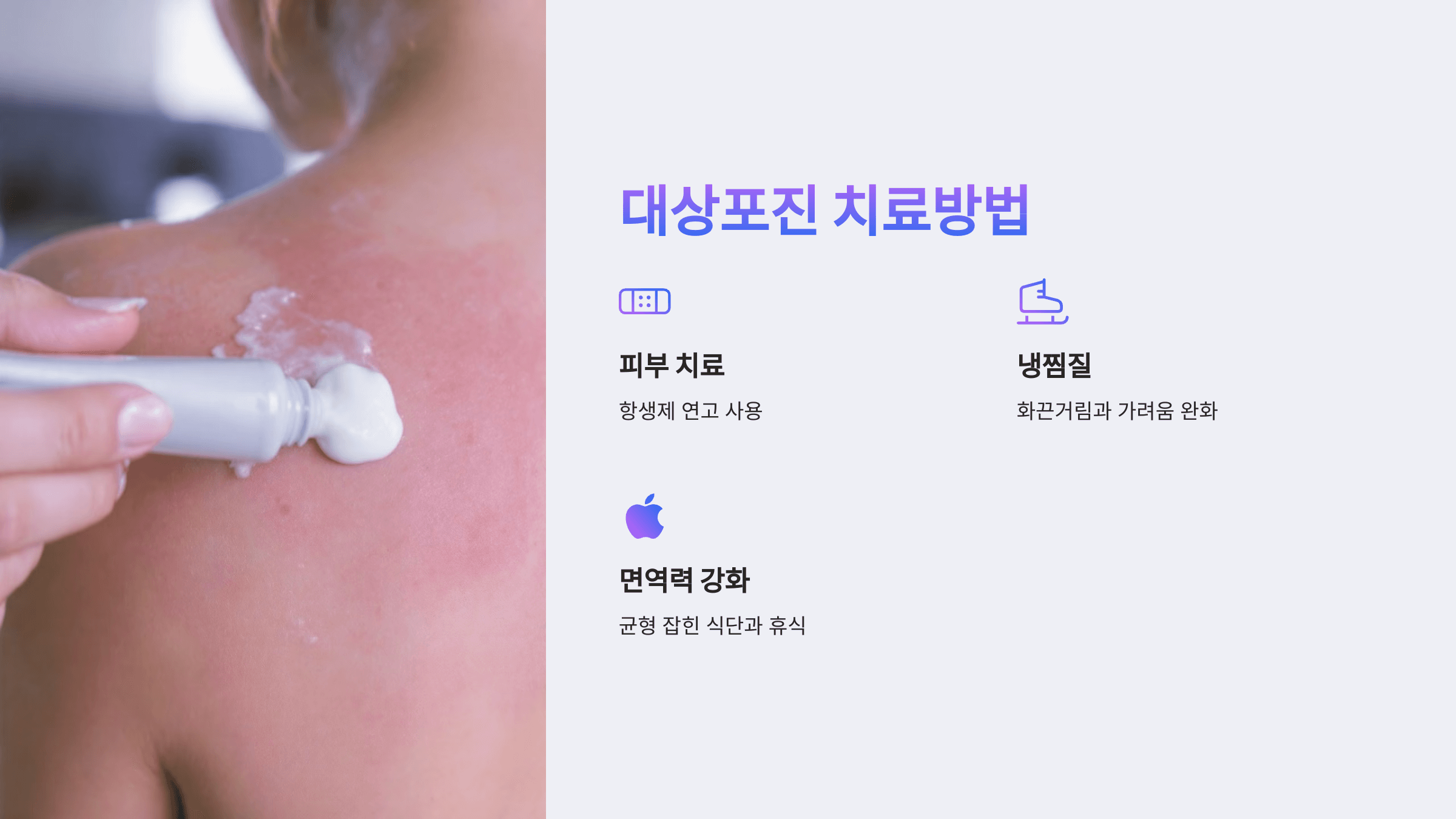 대상포진과 관련된 사진입니다.