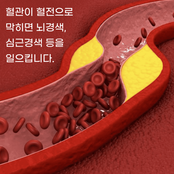 혈전용해제 나토키나제