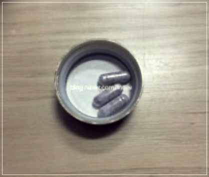 검정색변 증상 원인 진단방법 치료방안및 예방법