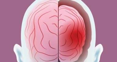뇌경색 초기증상&amp;#44; 원인&amp;#44; 예방법