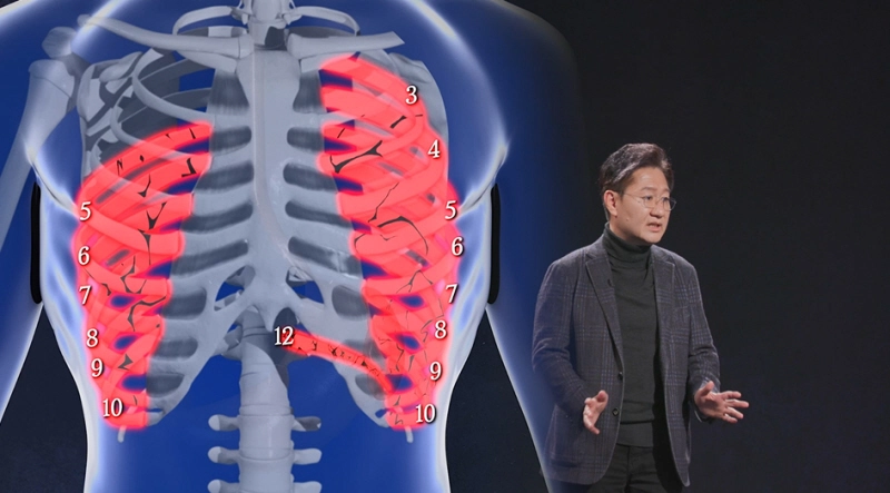 【KBS】 스모킹 건 - 제76회 꾀병 부리지 말라고 윤일병 사망 사건 방송 소개 제28보병사단 가해자