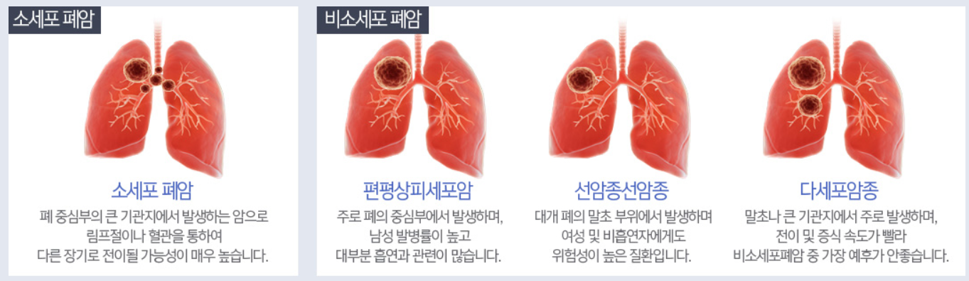 렉라자 fda
