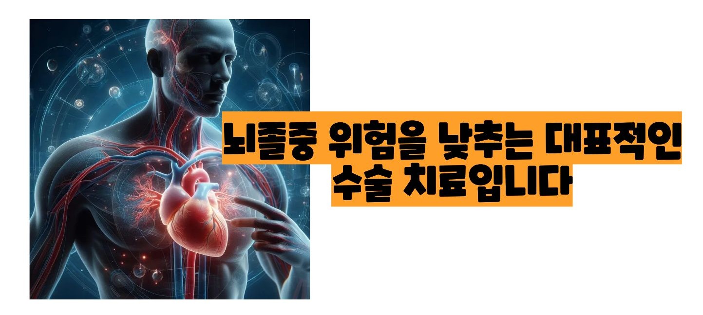 경동맥 협착증 치료