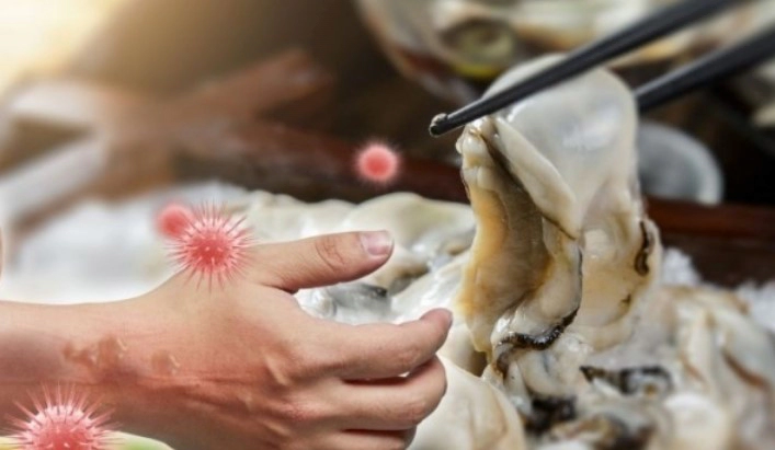 비브리오 패혈증 증상 18가지