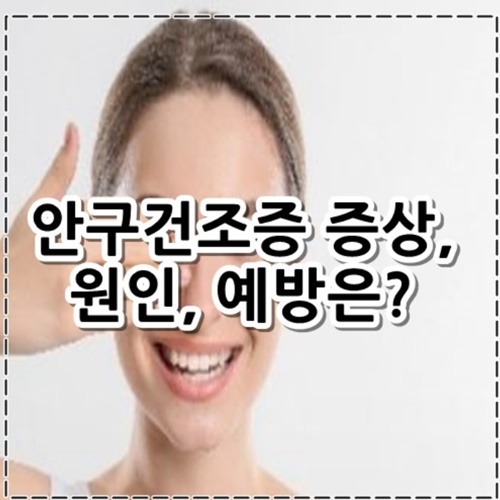 안구건조증 증상, 원인, 예방은?