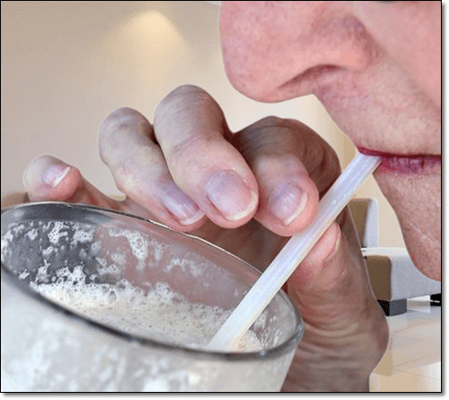 타피오카 먹는 체강 질병 노인