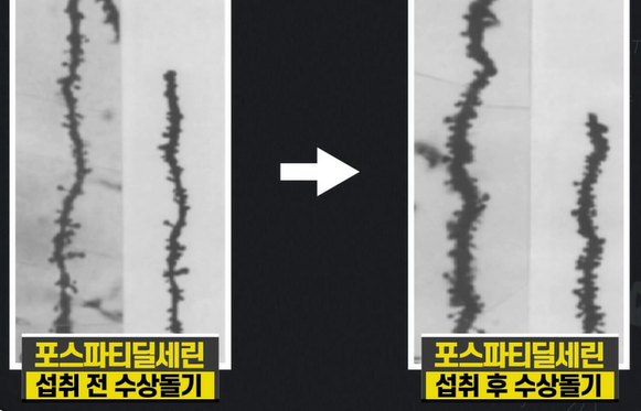 포스파티딜세린 효능