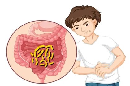 장과 배변 문제로 나타나는 주요 증상 정리3
