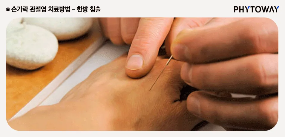 손가락 관절염 증상