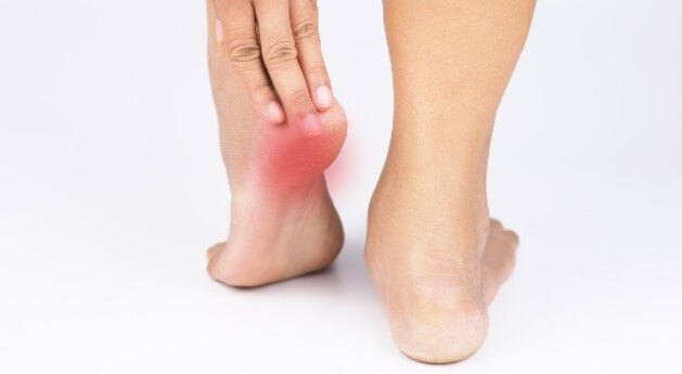 족저근막염 증상