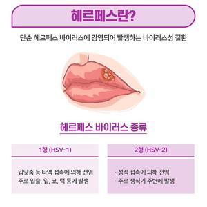 입술헤르페스(구순포진)란?