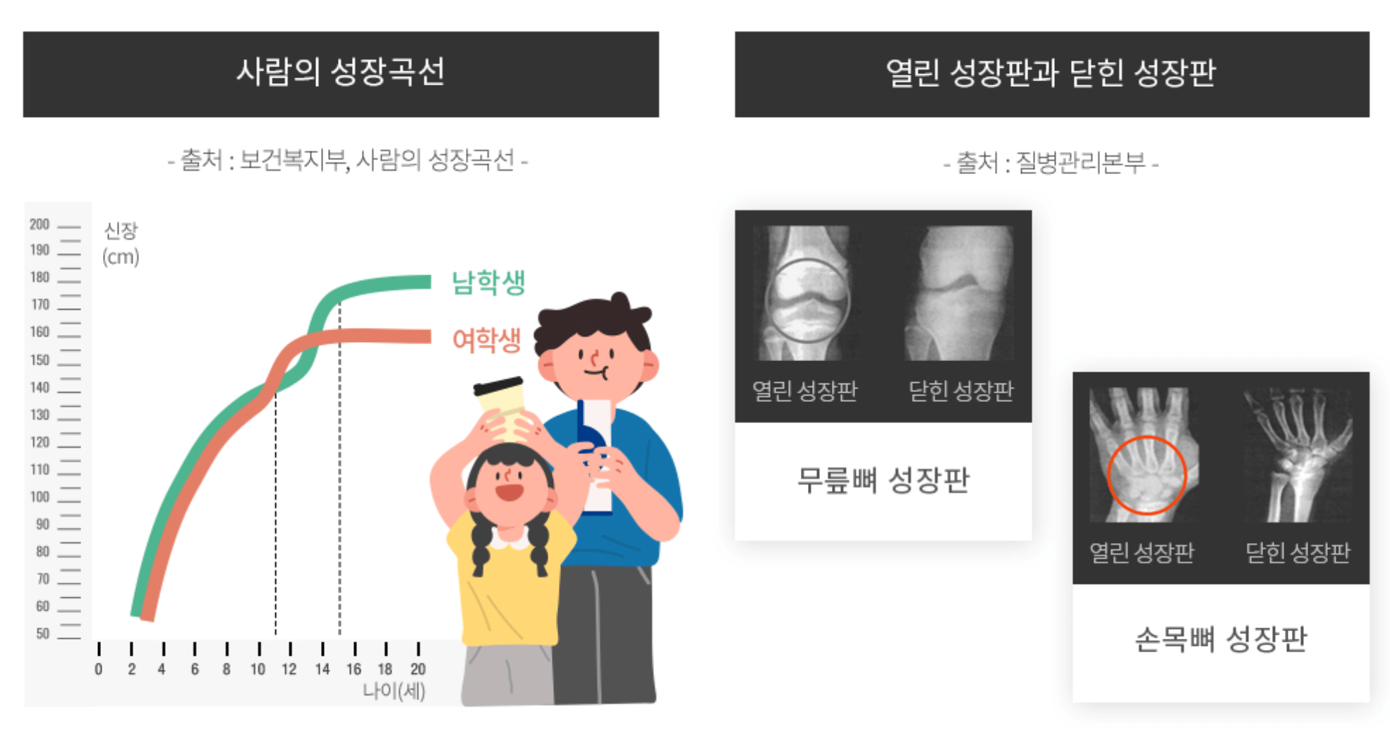 아이들 성장판