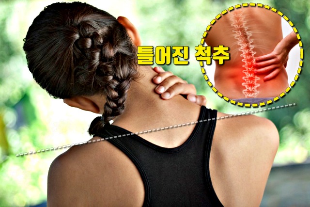 심장에 안좋은 습관 행동,양쪽어깨높이가틀림