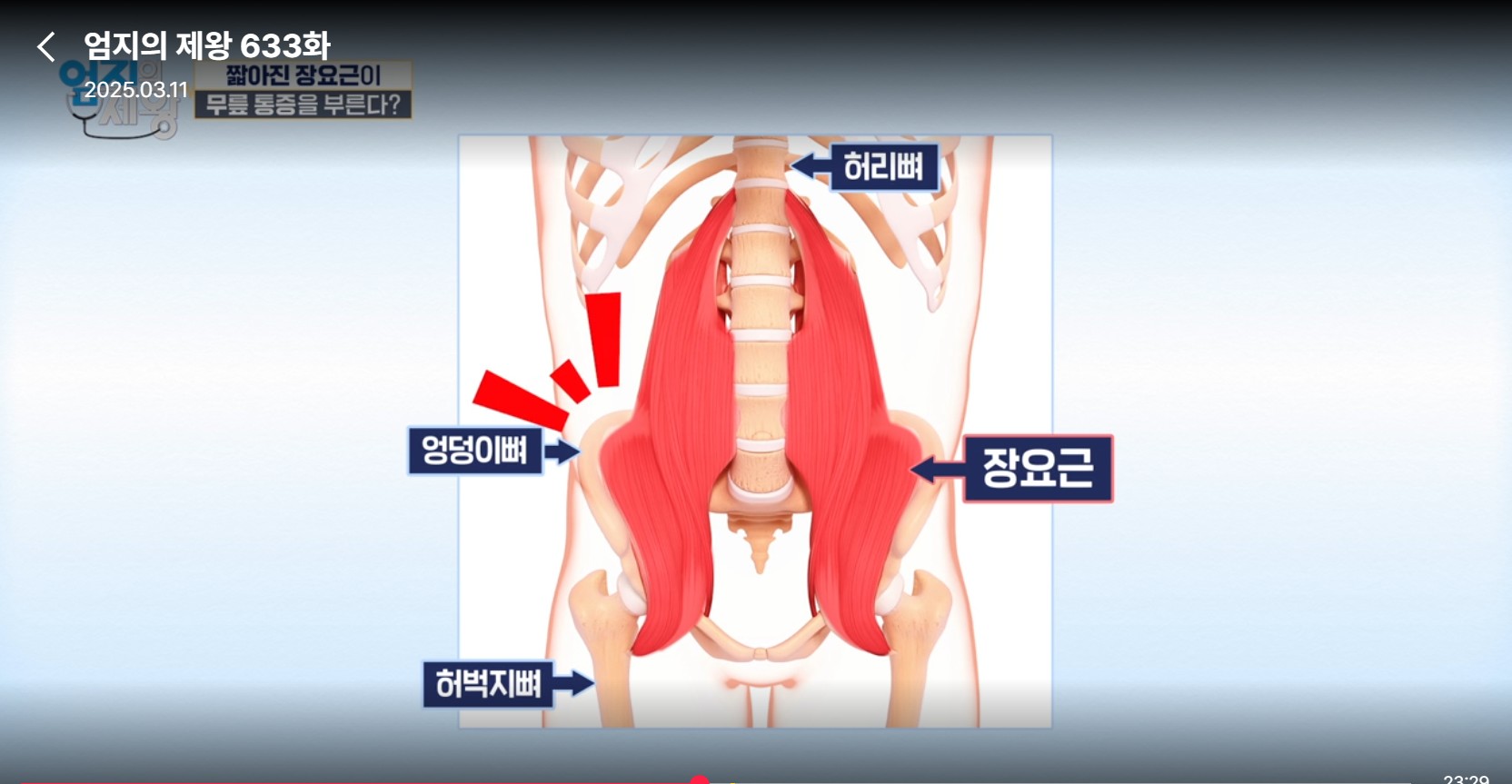 엄지의 제왕633화 무릎통증 배꼽옆 장요근 운동,연두부 레시피,난각막에 대하여