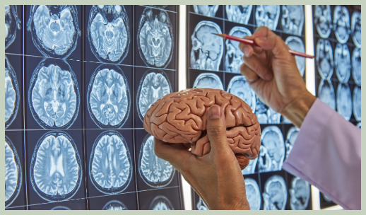 뇌출혈 위험인자