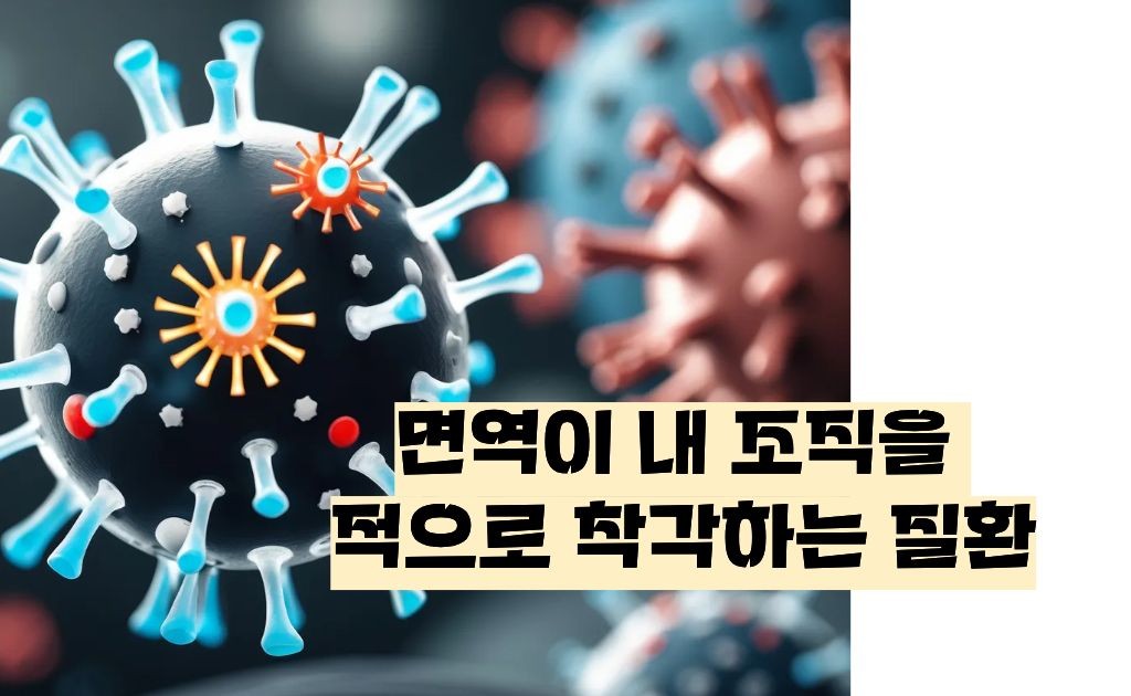 루푸스병 이란