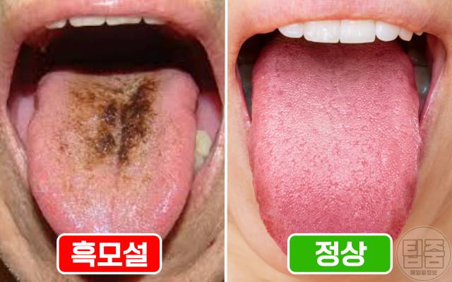 담배연기 삼키면 흑모설