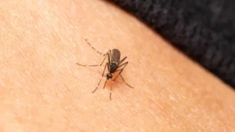 모기 물렸을 때 가려움증 없애는 법 효과적인 민간요법_19