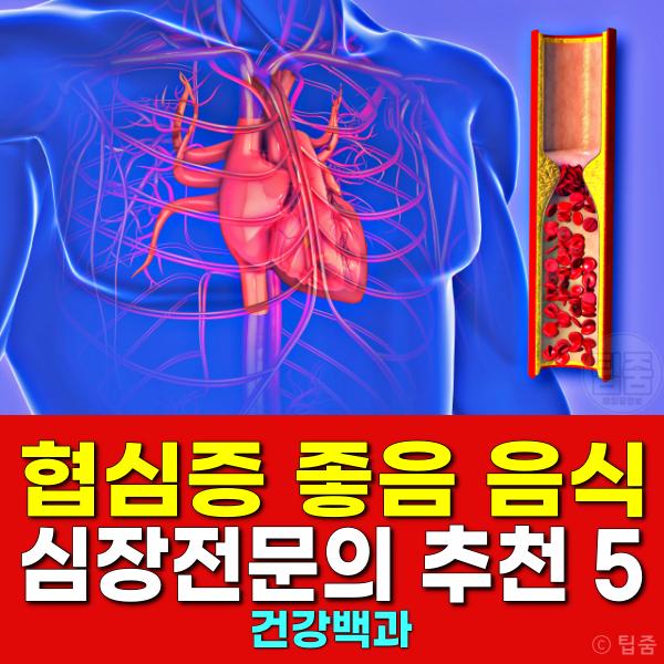 협심증 예방에 좋은 음식 심장 전문의 추천