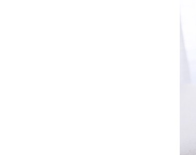 류마티스 관절염 초기증상