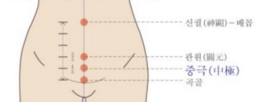 인체의 365혈 중에 아랫배 쪽에 있는 중극혈의 위치를 정확하게 표시를 하고 있는 이미지 사진