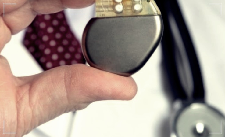 # 동성서맥(Sinus Bradycardia) 원인과 치료