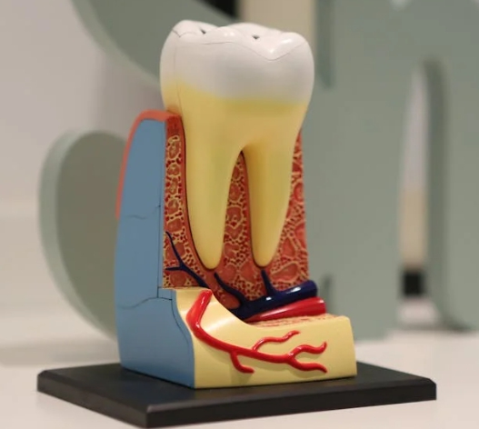 임플란트는 치아 건강을 위한 선택