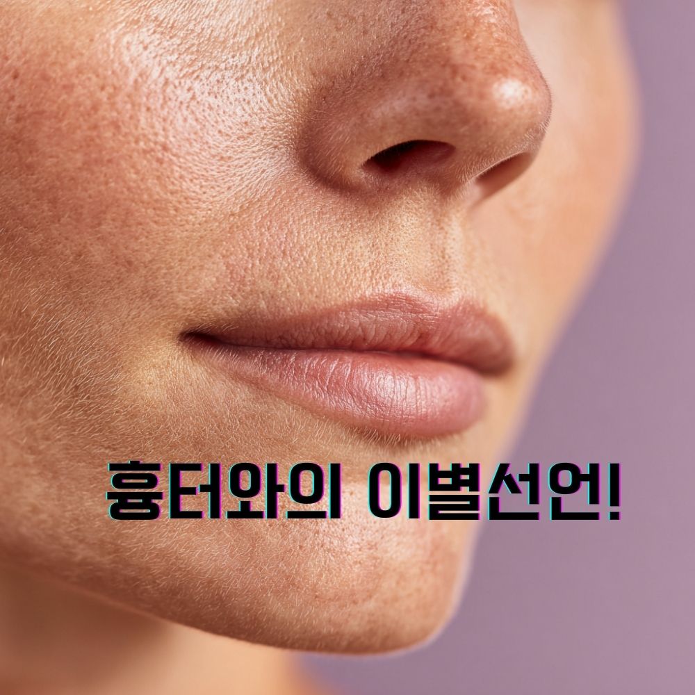 흉터와의 이별 선언!