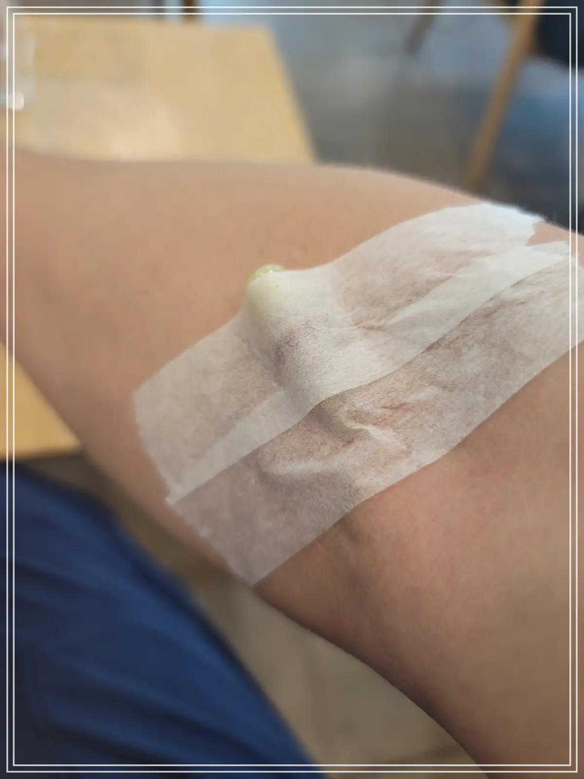 건강검진-수면-위내시경-주사