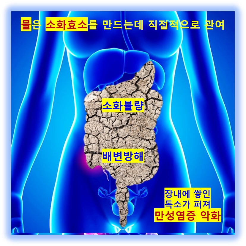 마이크로바이옴
