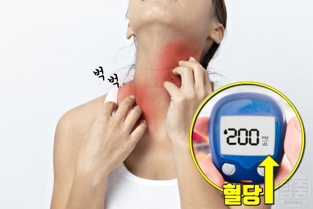 숨은 당뇨병 증상 가려움