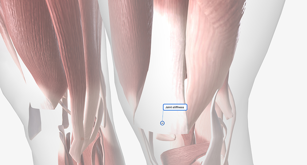 근감소증 자가진단