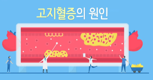 고지혈증의 원인