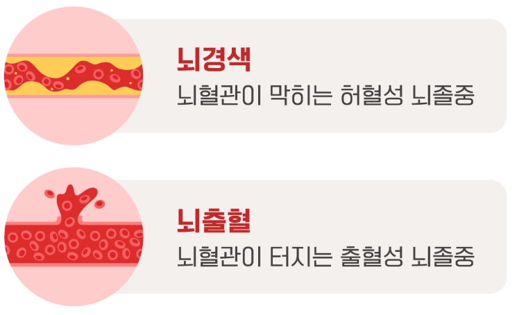 뇌혈관 관련 설명