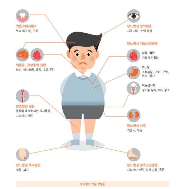 당뇨병 합병증