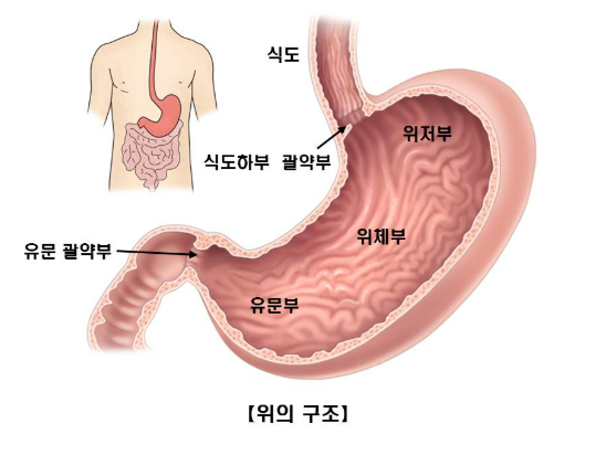 위암원인